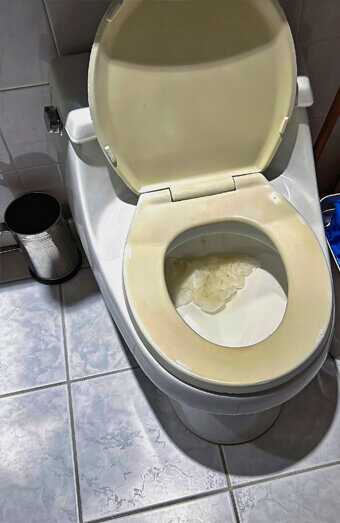 https://blockeddrainsparkwood.com.au/uploads/2025/07/blocked-toilet-27293.jpg